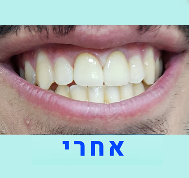 אמנון נגר מעבדת שיניים