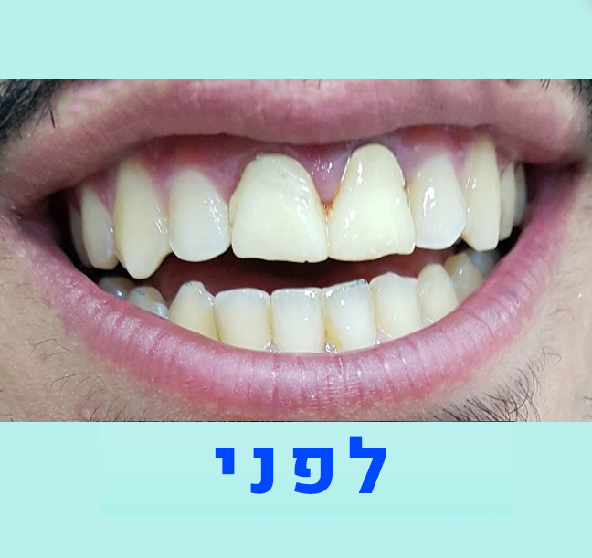 אמנון נגר מעבדת שיניים