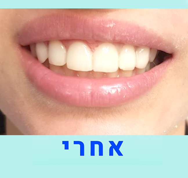 אמנון נגר מעבדת שיניים