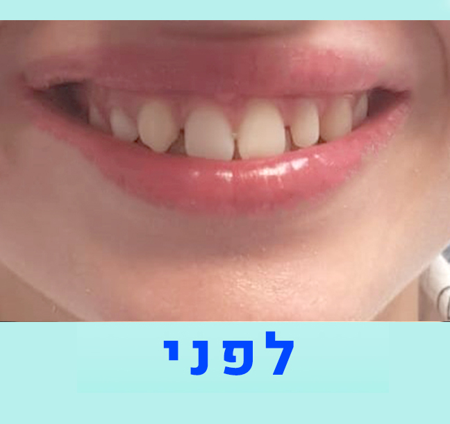 נעם-3-2
